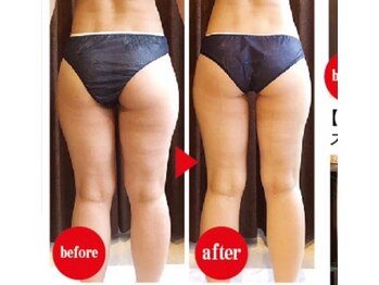 リアン(Riang)/下半身太りのお悩みに