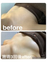 ギンザアール(GINZA R.)/バストアップ◎