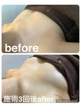 ギンザアール(GINZA R.)/バストアップ◎