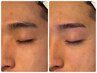 【メンズ美容1番人気】完全個室セレブメンズ美容鍼+毛穴洗浄+眉毛ワックス付