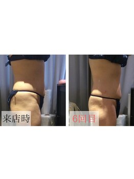 アンジュ(Ange)/セルゼロで綺麗なボディメイク★