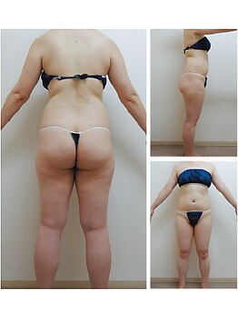 ガネェーシャ(Ganesha)/【大人気】エンダモロジー(2)