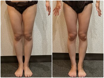 美容整体ウェリナ 名駅院/小顔矯正/骨盤矯正/美脚サロン