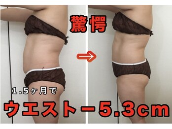 ラブランフェアリー/脂肪冷却モニター様の結果2☆