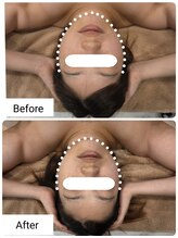 ルナリア ルクス 志木南口駅前店/小顔矯正　Before/After