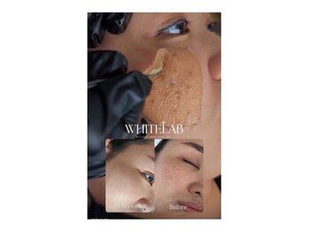 デピラード(Depilado)/