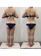 リラクラージュ(Ri Ra Courage)/ 50代２ヶ月後