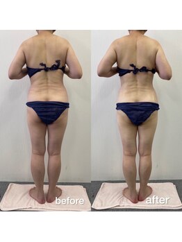 リラクラージュ(Ri Ra Courage)/ 50代2ヶ月後