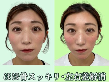 ナチュラルパーフェクトフェイス 新宿/目の高さ整う／新宿駅小顔