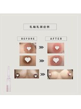 ワイスタイル(Ystyle)