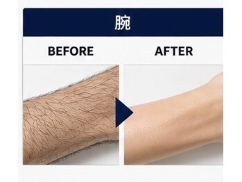 メンズエステ リア(Li'a.)の写真/【スマートな男の第一印象へ】起床後の準備を短縮して余裕のある一日に◇ひげ剃りダメージから顔を守る♪
