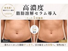 エーサウナ(A-SAUNA)