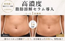 エーサウナ(A-SAUNA)