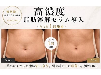 エーサウナ(A-SAUNA)の写真