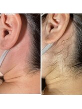 マイレ 銀座(MAILE)/うなじ