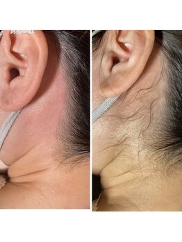 マイレ 銀座(MAILE)/うなじ