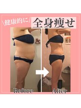 アンリール 旭川店(Anrire)/BODY施術のお客様です！