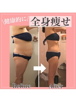 アンリール 旭川店(Anrire)/BODY施術のお客様です!