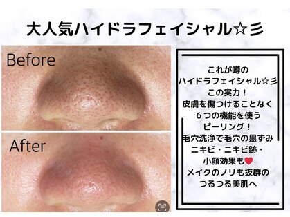 ルアナ(Ruana)の写真