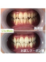 ルブラン 奈良店(Le Blanc)/男性の方も通いやすい