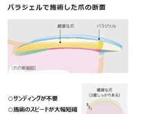 ユエム(UM)の雰囲気（パラジェルで長さだしをすることによって自爪を労われる★）