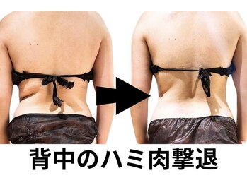 ニュートラル 池袋店(NEUTRAL)/施術結果【痩身/マッサージ】