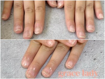 グレースレディ 神戸北店/