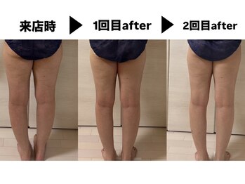 ヨサパーク サノン(YOSA PARK Sanon)/【温活】代謝upで体が変わる！