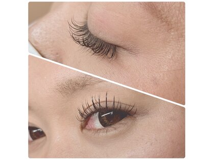 オメメビューティー(Omeme Beauty)の写真