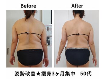 ユニクリア 佐賀(Uniclear)の写真/【佐賀で本格痩身ユニクリア】脂肪撃退!姿勢◎必要な筋力アップ!代謝促進で大人のボディメンテナンス