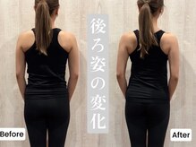 【Before After】★首肩/肩甲骨/背中周り矯正/ヒップライン