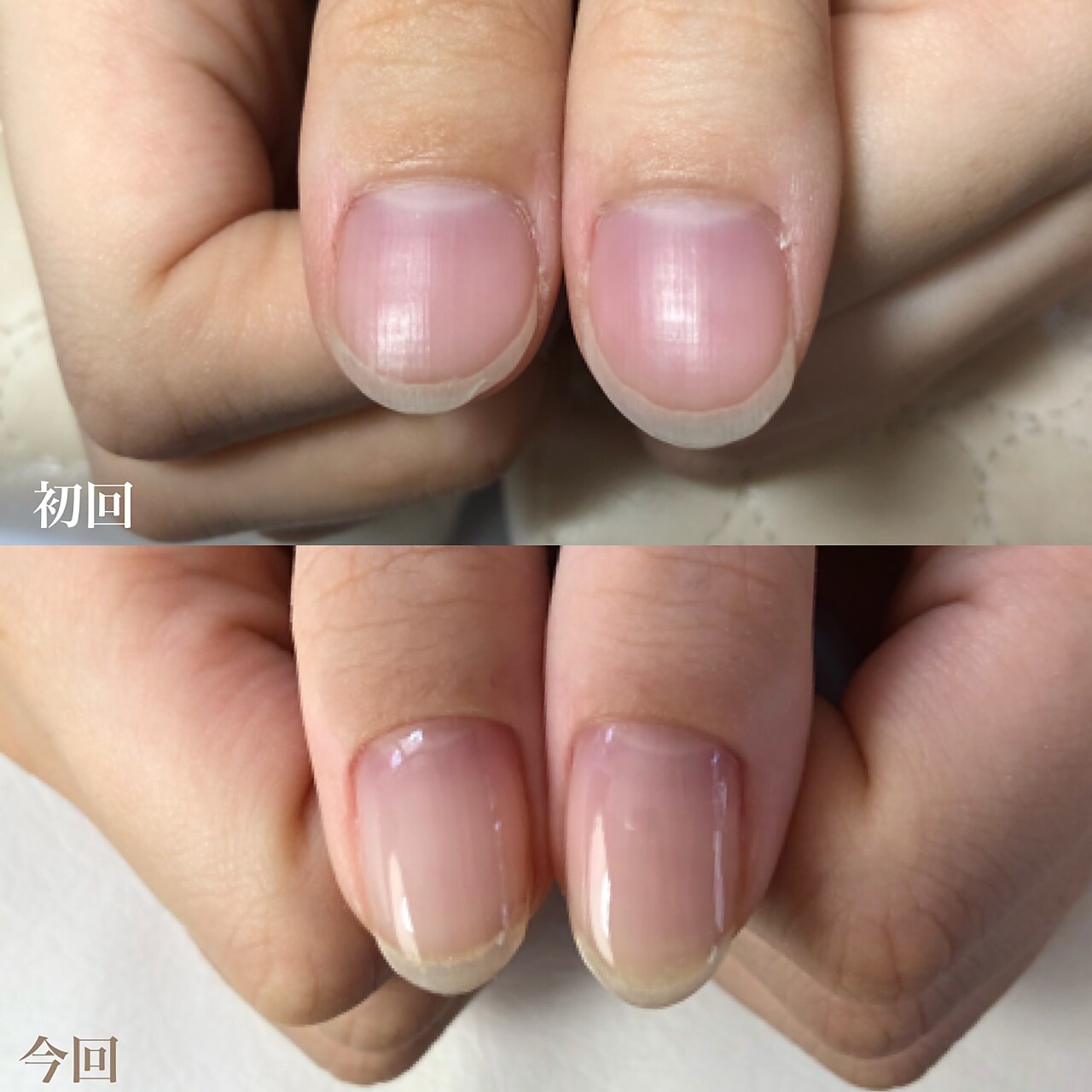 一番人気！自爪育成クリア \12,000