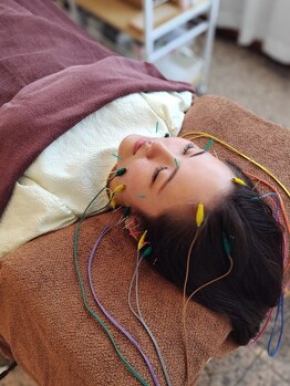 はりキュア(はりCure)の写真/リフトアップに特化した立体造顔美容鍼《姫リフト》鍼ならではの表情筋にアプローチし、効果を速攻実感！