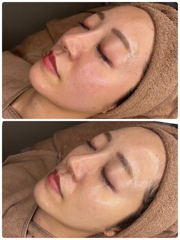 ユーイン 塩尻店(U-in)/ララピールビフォーアフター