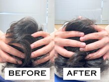 ビハリスト 池袋東口/頭のサイズからしっかり小顔に♪