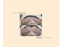 オベリオ(OBERIO)/