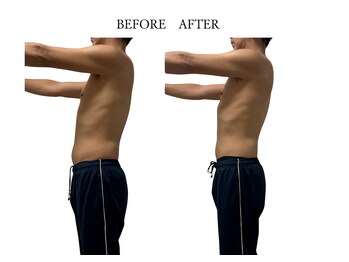 ヨサパーク サノン(YOSA PARK Sanon)/1回でもこの効果！