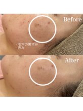 ジョアアンジェ 京橋店(joie ange)/アンストレス