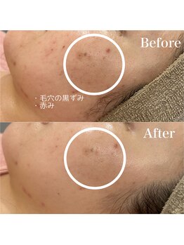 ジョアアンジェ 京橋店(joie ange)/アンストレス