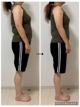 ソリ(soli)/before→after写真