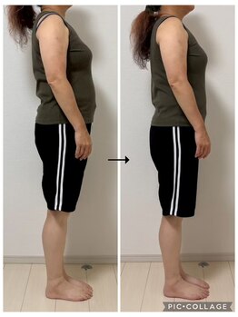 ソリ(soli)/before→after写真