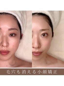 ホワイトカメリア(White Camellia)の写真/小顔が続かないのは骨格・筋肉・巡りのバランス崩れが原因。これらを整え持続する『本格小顔フェイシャル』