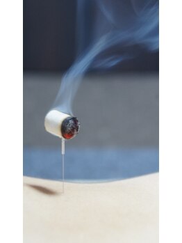 風香る鍼灸院/冷え改善にはお灸も(^^)/