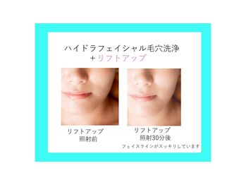リュクス(LUXE)/