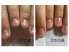 3カ月で縦長美爪へ♪爪のお悩み解決集中コース60分/計10回コース