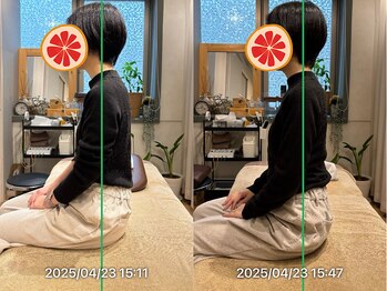 グレフル鍼灸接骨院 整体院 心斎橋/