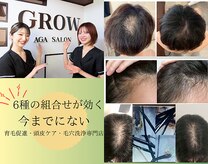 グロー 熊本(GROW)