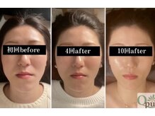 キュープ 浜松店(Qpu)/継続は力なり☆