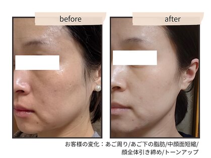 コンビンス(convince)の写真