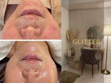 サロン グリッター 新宿(Salon GLITTER)
